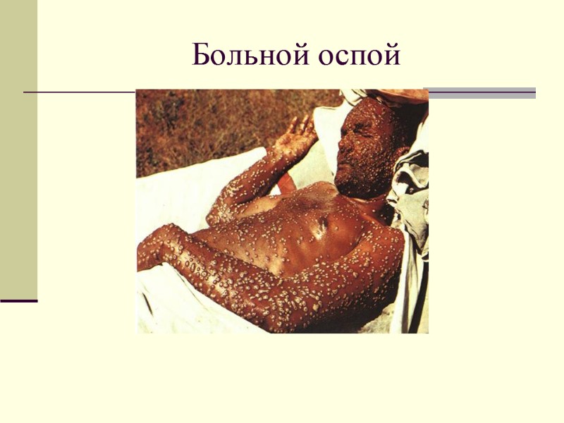 Больной оспой